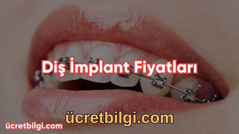 Dis Implant Fiyatlari