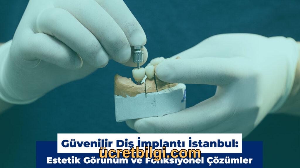 dis implanti istanbul